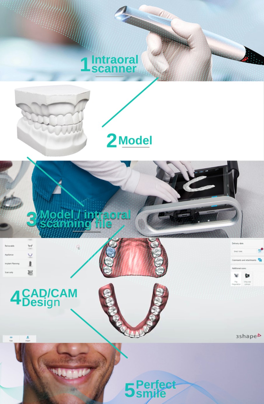 Intraoral scanner 1